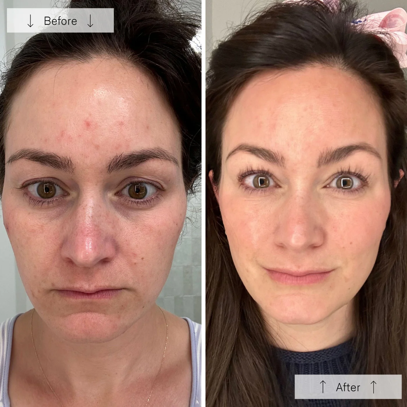 contour face ba 1 contour face ba 1