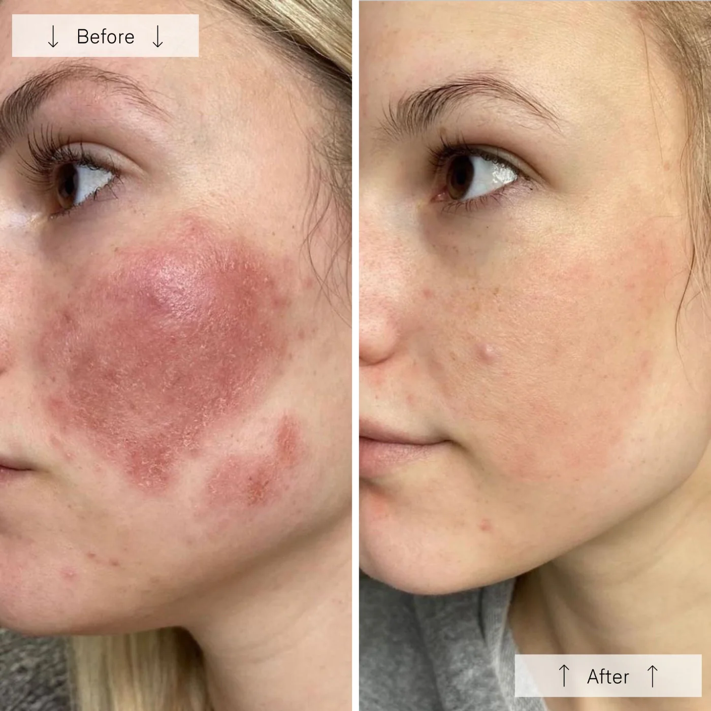 contour face ba 2 contour face ba 2