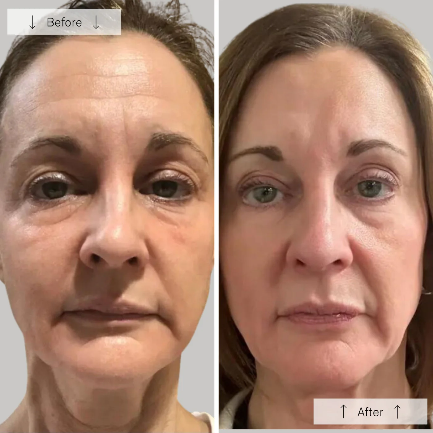 contour face ba 3 contour face ba 3