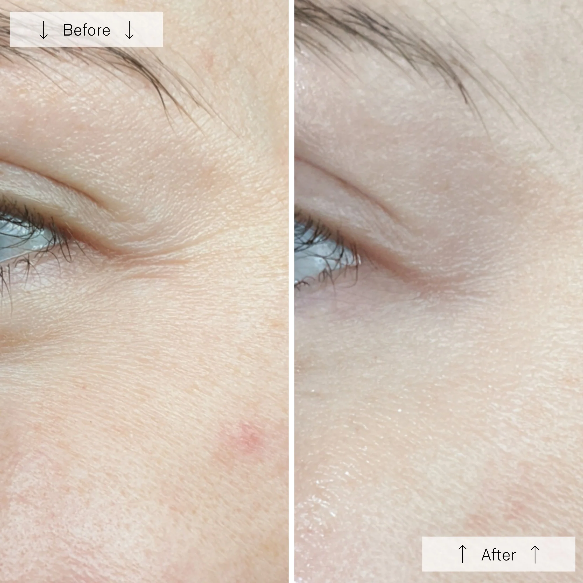 contour face ba 5 contour face ba 5